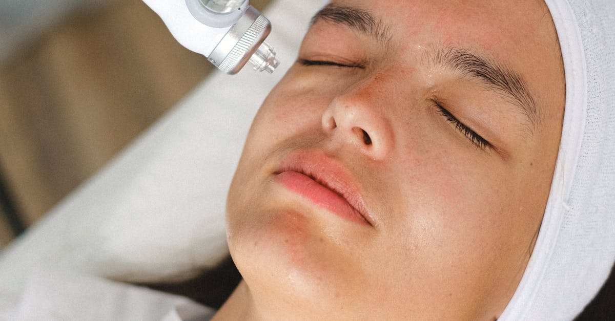 Combating Adult Acne with Medical Spa Treatments